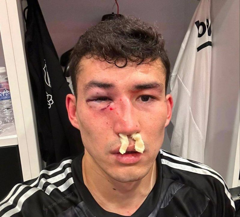 Экс-игрок ЦСКА Зайнутдинов попал в больницу, получив травму во время матча